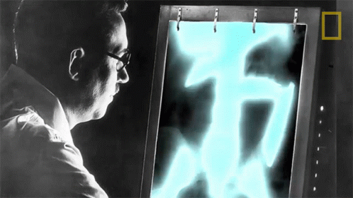Xray Result In The19th Century Going To The Doctor Could Kill You GIF - Xray Result In The19th Century Going To The Doctor Could Kill You Doctor GIFs