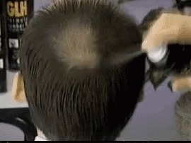 Bald Hair GIF - Bald Hair Chewbacca GIFs
