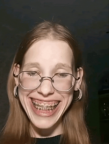 a girl with braces on her teeth wearing glasses