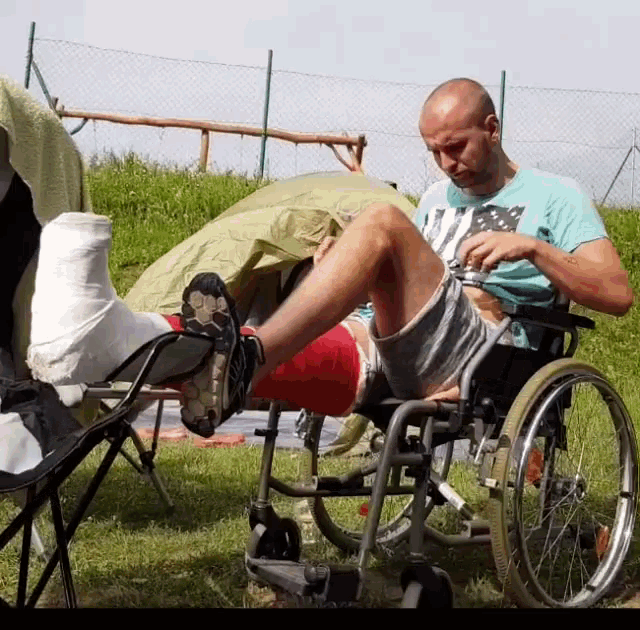 a man in a wheelchair with a broken leg