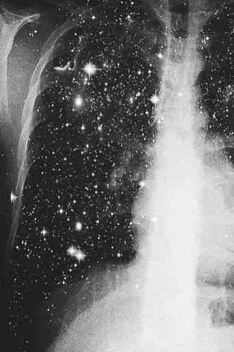 a black and white x-ray of a person 's lungs with stars in the background