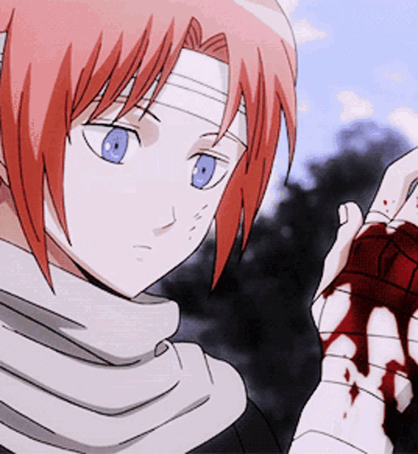 a girl with red hair and blue eyes is holding a bandaged hand