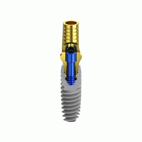 Biotec Implant B1conical Connection GIF - Biotec Implant B1conical Connection GIFs