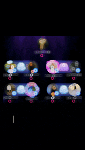 a blurred image of donuts with the words " asarimsan ailesi " at the bottom