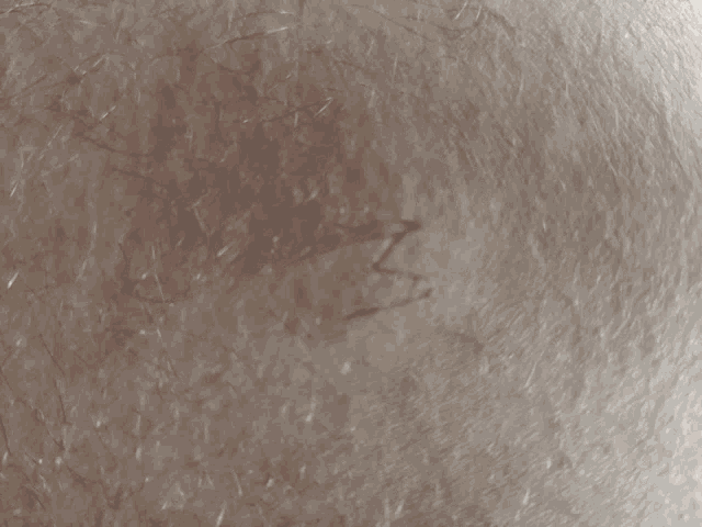 a close up of a person 's skin with the letter j written on it