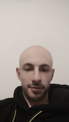 Bald GIF - Bald GIFs