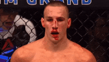 a man with blood coming out of his nose stands in front of a sign that says ground