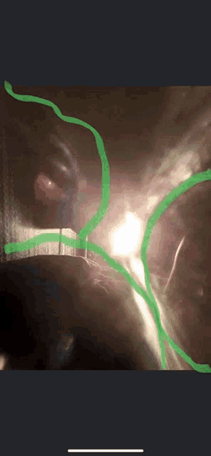a drawing of a person 's face with green lines going through it