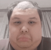 a close up of a man 's face with a bald spot on his head .