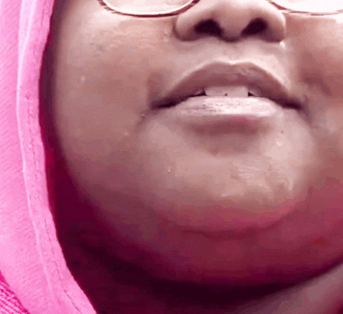 a close up of a person 's face with glasses and a pink hood