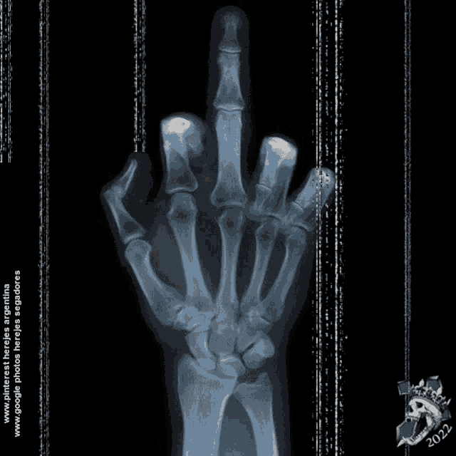 an x-ray of a hand with the year 2022 on the bottom right
