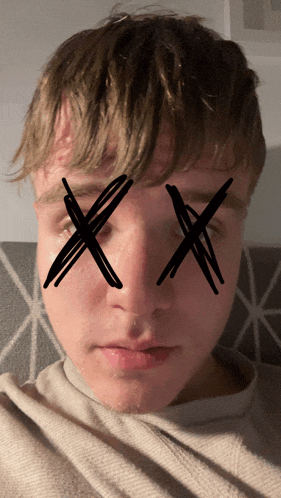 a close up of a man 's face with x 's drawn on it