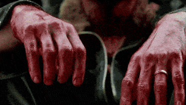 a close up of a person 's bloody hands with a wedding ring on the ring finger