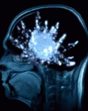 Beyin Mazgi GIF - Beyin Mazgi Baş GIFs
