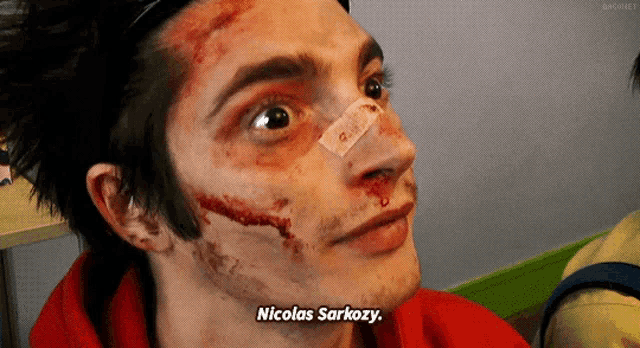 a man with a bandage on his nose says nicolas sarkozy
