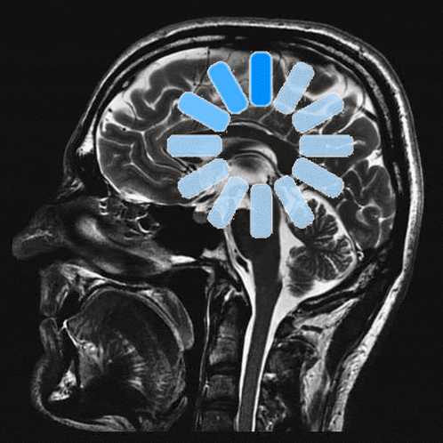 a black and white image of a person 's brain with a blue circle in the middle