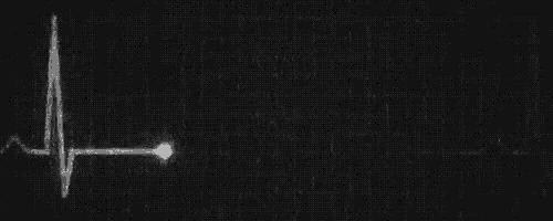 a black and white photo of a heartbeat on a black background