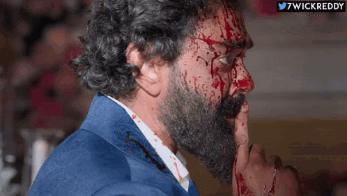 a man with a beard and blood on his face is covering his mouth with his finger .