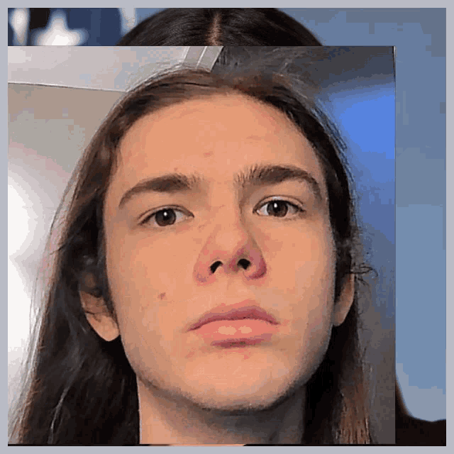 a close up of a man 's face with long hair and acne
