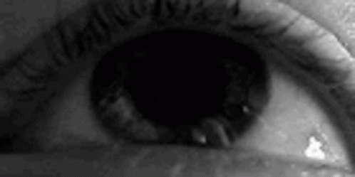 Nystagmus Eye GIF - Nystagmus Eye Shake GIFs