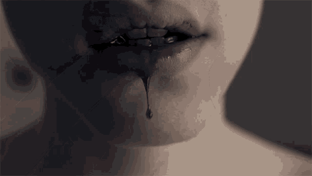 Wipe Off The Blood Collapse Song GIF - Wipe Off The Blood Collapse Song Bleeding GIFs