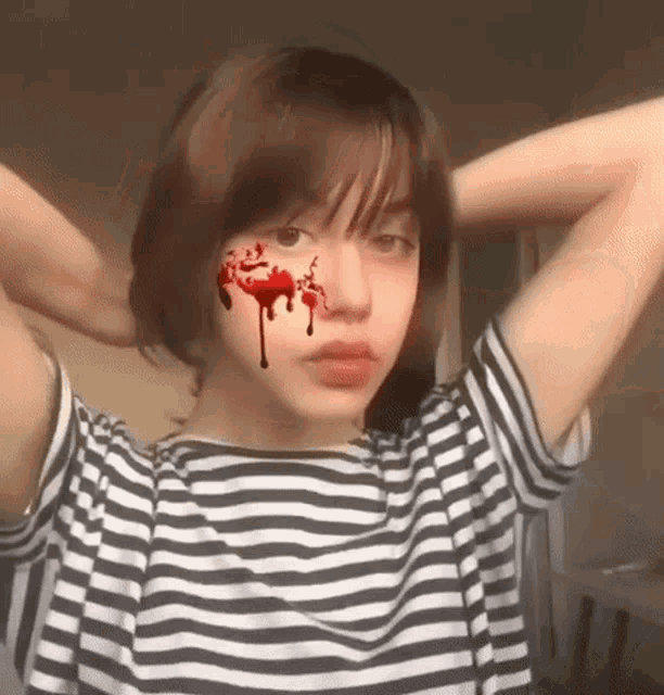the girl is wearing a striped shirt and has blood dripping from her face .