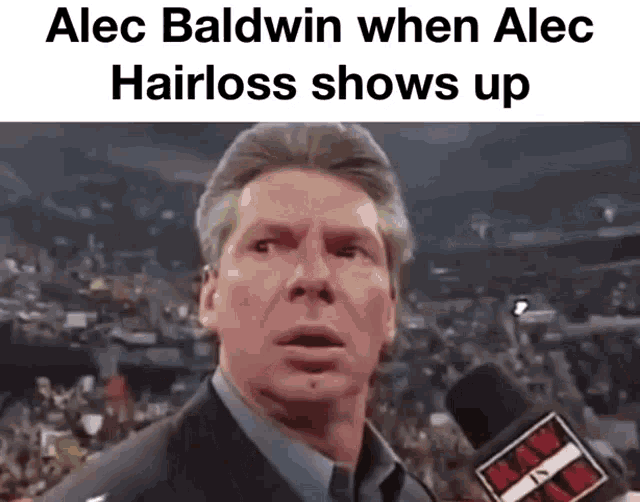 Alec Baldwin Hairloss GIF - Alec Baldwin Hairloss GIFs