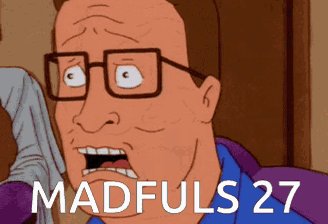 king billy from king of the hill has madfuls 27 on his face