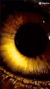 a close up of a person 's eye with a caption that says cap cut
